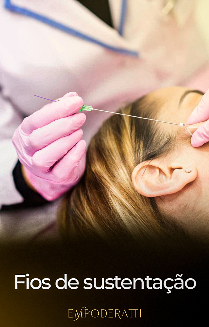 fios-de-sustentação